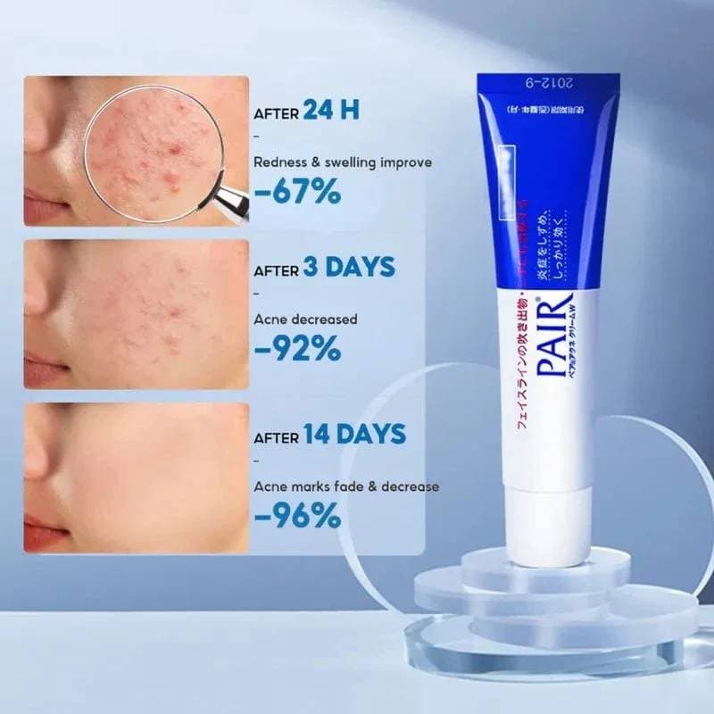 Lion Pair Medicated Acne Care Cream 14g thumbnail 2